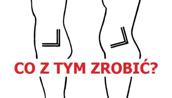 Blogujmy24.pl: Przodopochylenie miednicy - ćwiczenia., Artykuły | Mięśnie