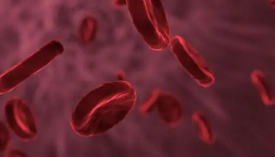 Blogujmy24.pl: Anemia - niedokrwistość, Artykuły | Anemia