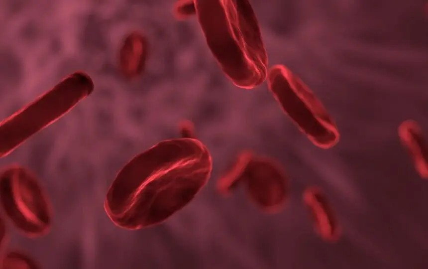 Blogujmy24.pl: Anemia - niedokrwistość, Artykuły | Anemia