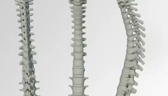 Blogujmy24.pl: Adaptacja i regeneracja dysku, Artykuły | Dysk międzykręgowy