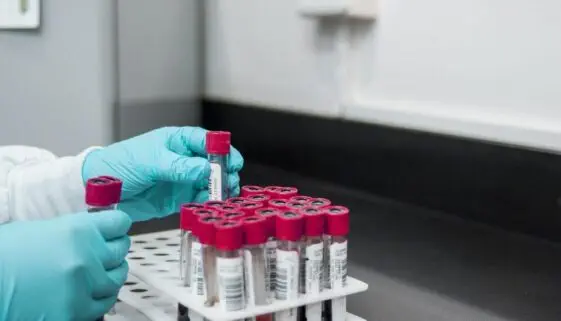 Blogujmy24.pl: Długość estrów w środkach dopingujących., Artykuły | Doping
