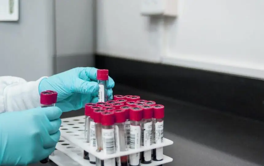 Blogujmy24.pl: Długość estrów w środkach dopingujących., Artykuły | Doping