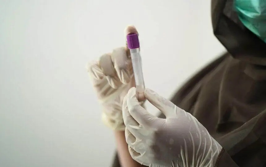 Blogujmy24.pl: Okresowe badania krwi podczas cyklu sterydowego., Artykuły | Cykl sterydowy