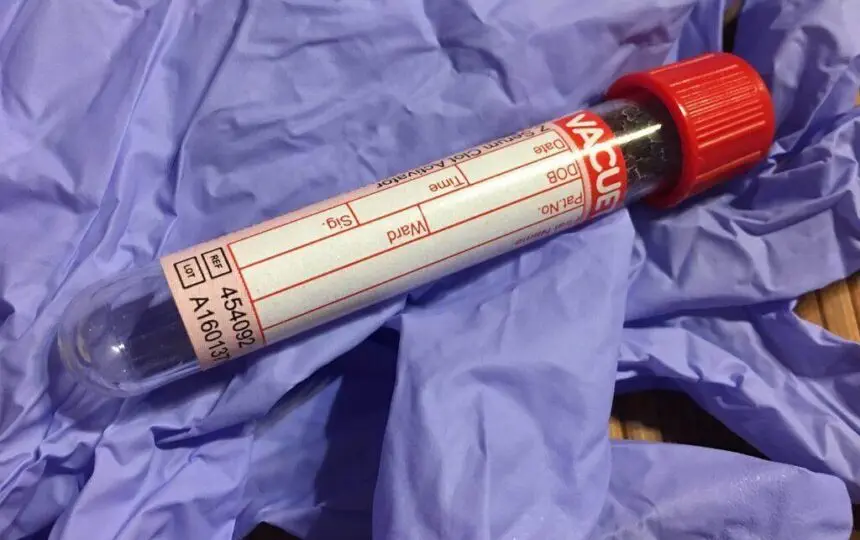 Blogujmy24.pl: Erytropoetyna (EPO) – efekty i skutki uboczne., Artykuły | Doping