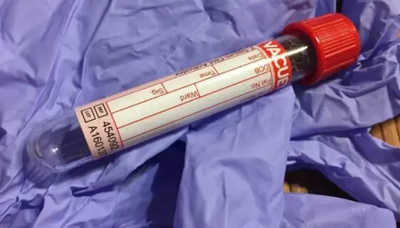 Blogujmy24.pl: Erytropoetyna (EPO) – efekty i skutki uboczne., Artykuły | Doping